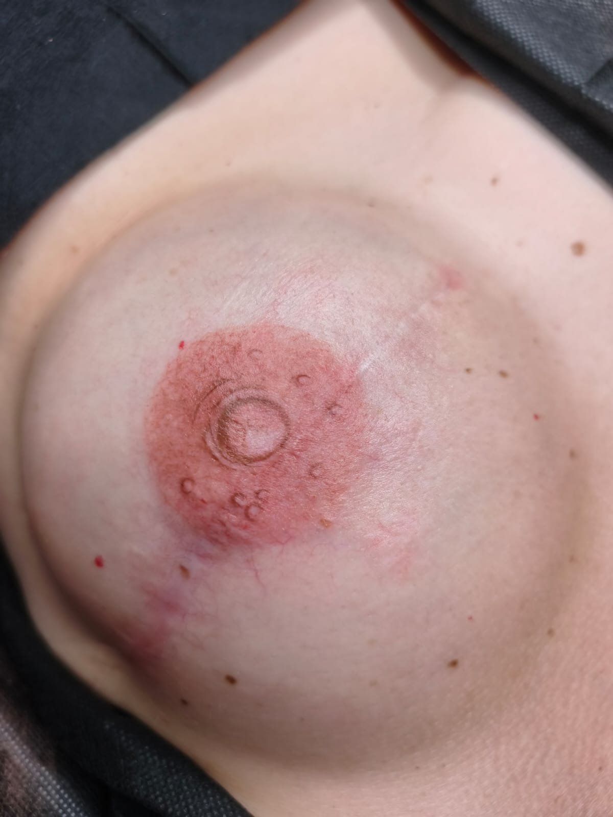 Areola Moon
